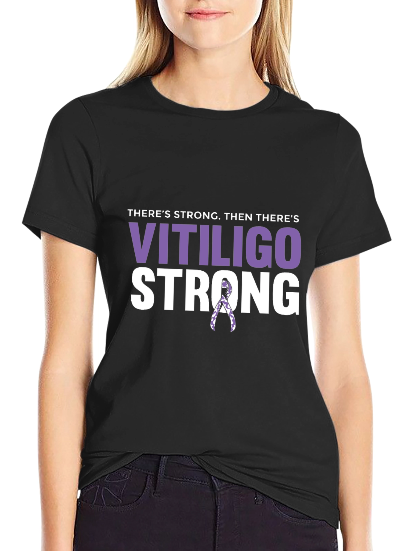 Vitiligo Strong T-Shirt - Awareness Support Tee