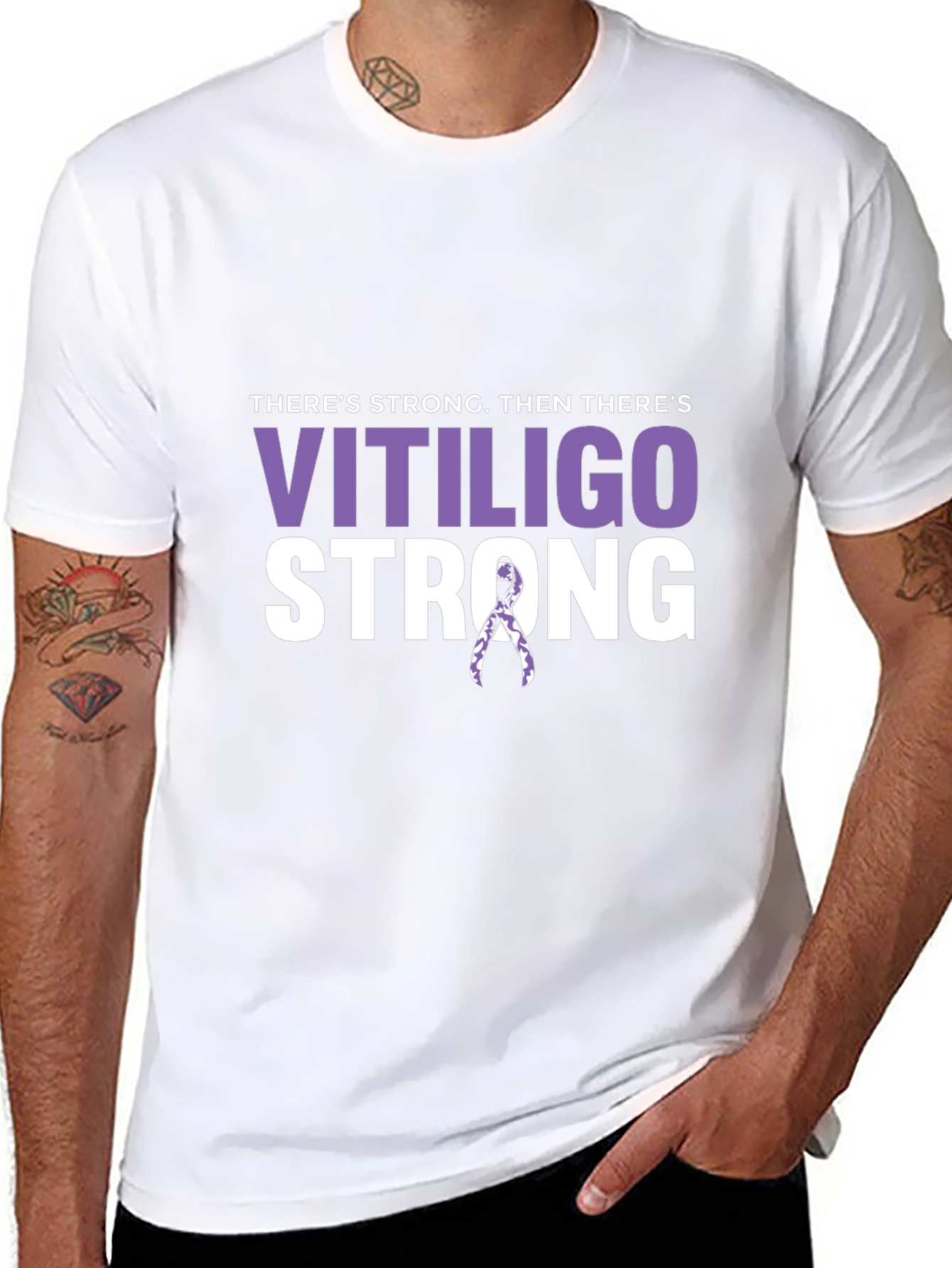 Vitiligo Strong T-Shirt - Awareness Support Tee